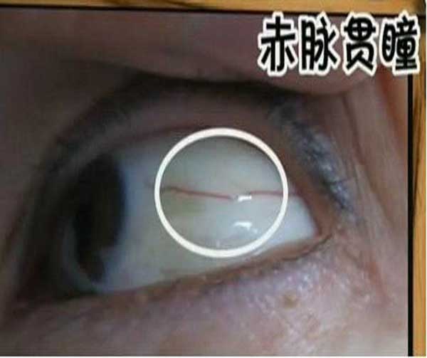 长期吃槟榔的危害图片_危害健康的图片_手机长期玩游戏的危害图片