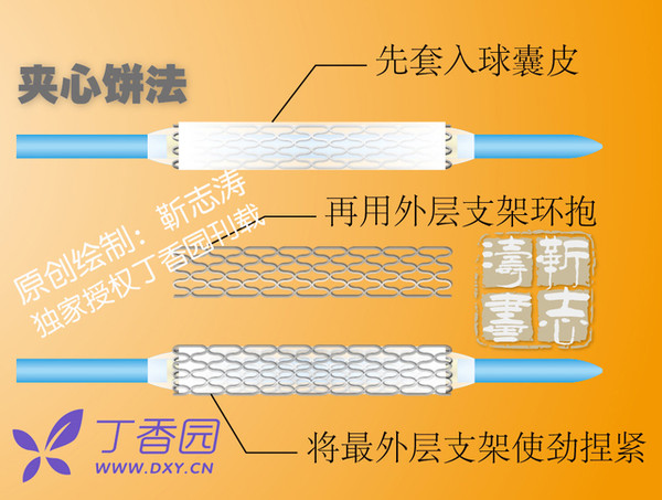 修理手机支架游戏_支架破损手机_手机游戏支架自己做