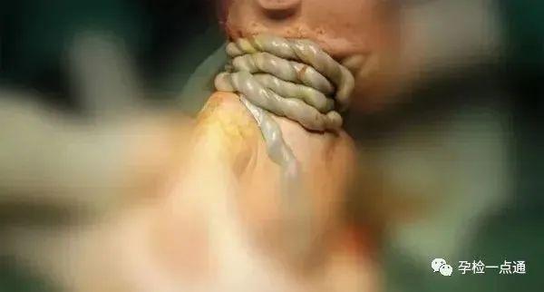 用手机玩游戏会胎停吗吗_玩手机游戏会用胎停的手机吗_打游戏会胎停吗