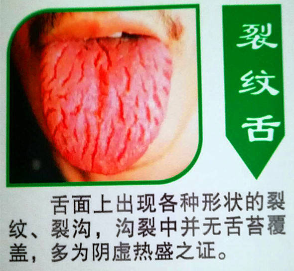 望闻问切四诊法是谁发明的?_望闻问切诊法是谁发明的_望闻问切等诊断手法的名医是谁