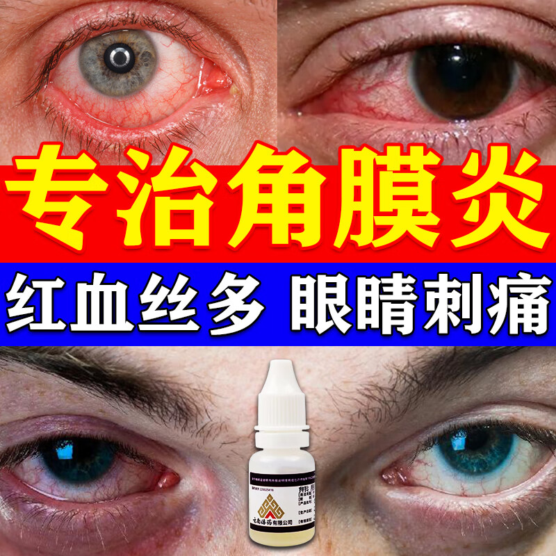 玩手机玩电脑游戏眼睛红_玩电脑眼睛有红血丝怎么办_玩电脑眼睛红怎么办