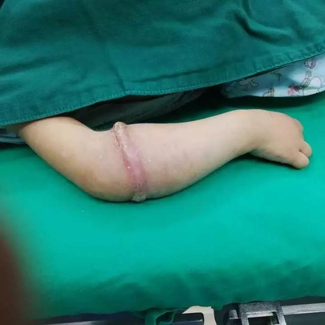 小孩玩手机游戏辐射视频_手机辐射儿童_儿童玩手机有辐射吗